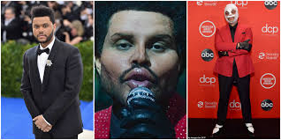 The weeknd finally takes off his bandages to reveal creepy new look with fillers. T1gnmece3bn5xm