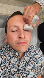 Optic Nerve Sheath Measurement