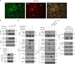 Hk ang & partners as a legal assistant in 2015 and thereafter joined messrs. Dishevelled Has A Yap Nuclear Export Function In A Tumor Suppressor Context Dependent Manner Nature Communications