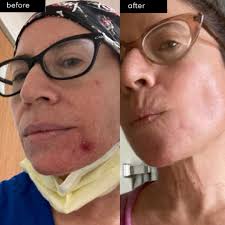 Dr Sandra Lee aka drpimplepopper