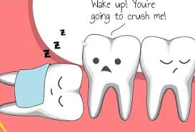 Removes harmful plaque · foam formula cools gums Quality Wisdom Teeth Care By Highly Experienced Dentist