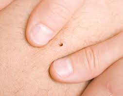 There are generally charges for these services. Lyme Disease Misdiagnosis
