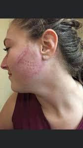 Smallest 4U facemasks for young players