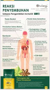 Kebanyakkan wanita tidak mempunyai sebarang tanda. Reaksi Pentembuhan Healing Inchaway Global Istar Facebook
