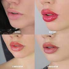 Lip Blushing Faqs Our Smart Guide To Cosmetic Lip Tattoo Tattoodo Cosmetic Lip Tattoo Lip Permanent Makeup Lip Color Tattoo