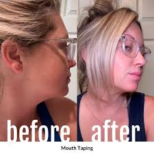 Unlocking the Benefits of Mouth Tape for Better Sleep and Health