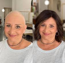 Wig donation for trauma victim?