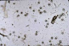 With appropriate and prompt treatment, the. Coccidia Hancock Park Veterinary Clinic