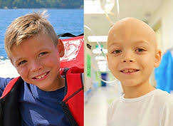 Childhood Kidney Cancer