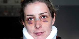 Aiuta l'amica a lasciare il marito e viene presa a pugni: "Picchiata per  vendetta"