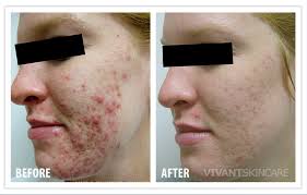 Vivant products, Vivant pharmaceuticals, Vivant skin care products