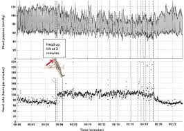 Here's what long haulers may experience. Autonomic Dysfunction In Long Covid Rationale Physiology And Management Strategies Rcp Journals