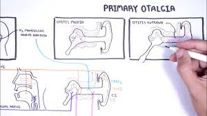 Image result for Otalgia