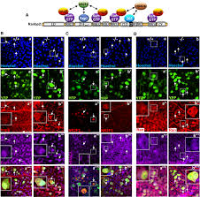 Soon gan dion & partners is a malaysian law firm offering a full range of legal services in collective investment schemes, banking, general corporate and mr. Microglial Activation In An Amyotrophic Lateral Sclerosis Like Model Caused By Ranbp2 Loss And Nucleocytoplasmic Transport Impairment In Retinal Ganglion Neurons Springerlink