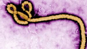 Comme son nom l'indique, elle est due au virus ebola, qui appartient à la famille des filovirus. Ebola Epidemie Das Sind Die Symptome Des Virus