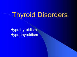 Graves' disease is the most common cause of hyperthyroidism in the united states. Thyroid Disorders Hypothyroidism Hyperthyroidism Ppt Video Online Download