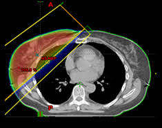 We did not find results for: Treatments Ucla Radiation Oncology Los Angeles Santa Monica Ca