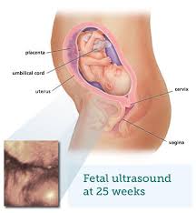 At 11 weeks, the fetus is about the size of a brussels sprout. Fetal Ultrasound 6 Months Babycentre Uk