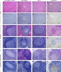 Maybe you would like to learn more about one of these? Prior Vaccination With Rvsv Zebov Does Not Interfere With But Improves Efficacy Of Postexposure Antibody Treatment Nature Communications