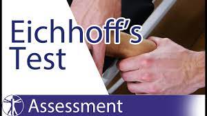 Finkelstein's test is an orthopedic test for diagnosing dequervain's tenosynovitis. Finkelstein Test De Quervain S Tenosynovitis Youtube