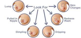 But ignorance about the disease is not doing to help you. Breast Cancer Symptom Causes Treatment Self Exam How To Relief