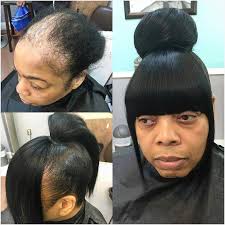 Tag Hairbydonetta Fakeittilumakeit Alopeciaslay Naturalhair Transformation Quickweave Updo Bun Bangs Kilt Alopecia Hairstyles Epic Hair Hair Plugs