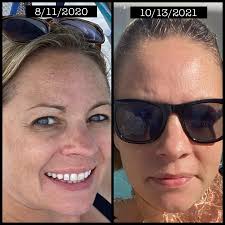 Has anyone had good results with this brand for their skin?