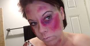 Dystonia Dynamos Team 550 Carson Hardy Joel Ashburner Elizabeth Leech Jack  Flynn Jonah Hardy Lauren Ashburner Margaret Harrison Shelagh Morrall