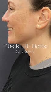 Relaxed. Lifted. Snatched 🙌, 🌺 For the month of June, when you purchase  24 units of Botox to treat the platysma bands in the neck, you’ll receive  an additional 16 units for the jawline—completely ...