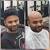 Before And After Hair System For Men