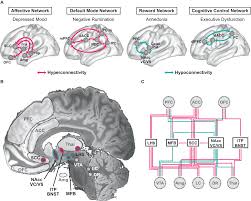 Image result for Refractory Depression Management