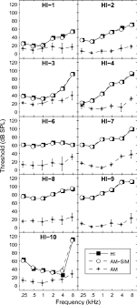 Threshold In Db Spl As A Function Of Frequency In Each