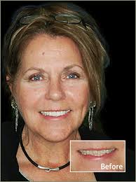 Scottsdale Dental Specials