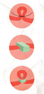 Elles permettent de récupérer l'ovule libéré par il existe de nombreuses façons de se faire ligaturer les trompes, mais aucune d'entre elles ne fait de « nœud » à vos trompes 6 x source de recherche. Ligature Des Trompes Une Contraception Definitive Gyn Co