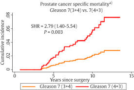 However, as with other types of cancer,. Increased Prostate Cancer Specific Mortality Following Radical Prostatectomy In Men Presenting With Voiding Symptoms A Whole Of Population Study Sciencedirect