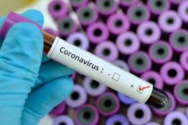 Coronavirus: el test ya se podrá hacer en otras provincias