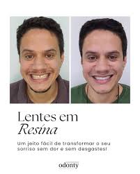 Cuidar do seu sorriso é fundamental para a sua saúde e sua autoestima.  Estudos comprovam que pessoas que sorriem mais (e sem medo) são mais  felizes, conseguem se relacionar melhor com outras