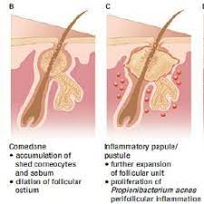 Ceramide ointment cream | крем мощное увлажнение. Pdf Determination Of Permeation Pathway Of Gentamicin Into Piga S Ear Skin
