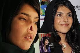 Bibi Aisha bravely shows her new face after Taliban cut off her nose and  ears