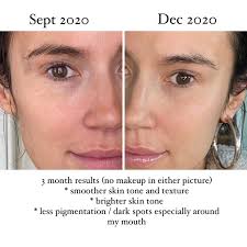 The lotion is light and refreshing and doesn't leave my skin feeling oily or greasy and the serum has been great to help with any stubborn acne. Juice Beauty Juice Beauty Added A New Photo Facebook
