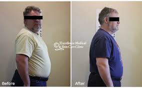 Look at several of 32 comments below to ensure you will . Excellence Medical Skincare Clinic Sherwoodpark In Sherwood Park Edmonton