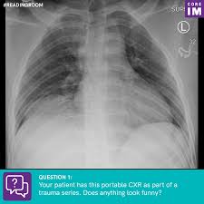 If you fail, then bless your heart. Your Patient Has This Portable Cxr As Part Of A Trauma Series Does Anything Look Funny Core Im Podcast
