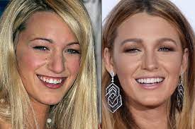 Blake lively ihre kinder wurden von einem paparazzo gestalked blake lively hat eine erschreckende erfahrung mit einem paparazzo gemacht. So Sehr Verandern Augenbrauen Das Gesicht Gesicht Mode Schonheit Augenbrauen