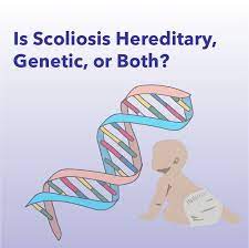 Is Scoliosis Hereditary Genetic Or Both Does Enviornment Play A Role Scoliosis Genetics Hereditary