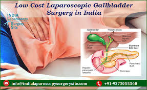 Gallbladder cancer treatment cost in india is much less when compared to any other countries. Laparoscopy Purpose Procedure Recovery Low Cost Laparoscopic Gallbladder Surgery In India But Best Results To Offer Big Boon For Global Patients