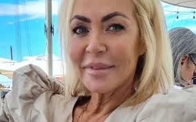 Elsa Raposo mostra-se após tratamento estético mal feito