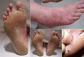 Abnormalities of the skin, nerves, bones, blood vessels, and soft tissues of the foot can result in foot pain.evaluating the cause of foot pain can require an understanding of the anatomy and physiology of not only the foot, but also the ankle, lower extremity, and lower spine. 19 Common Foot Disorders