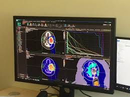 Les protons irradiants sont produits à partir d'atomes d'hydrogène. Herouville Saint Clair Cancer Cyclhad Caen Le Troisieme Centre De Protontherapie En France