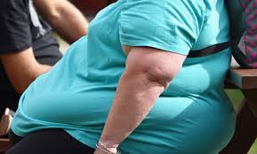 Image result for Obesity