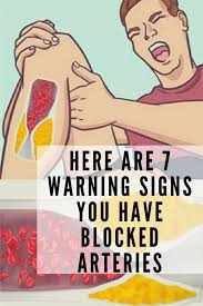 Here Are 7 Warning Signs You Have Blocked Arteries Arteries Warning Signs Anti Cancer